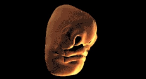 Human face forming in the womb - 03