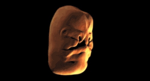 Human face forming in the womb - 05