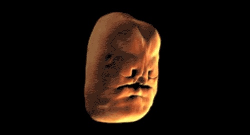 Human face forming in the womb - 07
