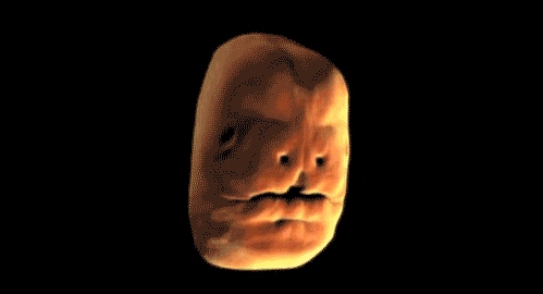 Human face forming in the womb - 09