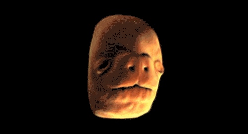 Human face forming in the womb - 10