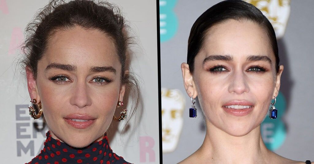 Emilia Clarke Is Missing 'Quite A Bit' Of Her Brain After Two Aneurysms