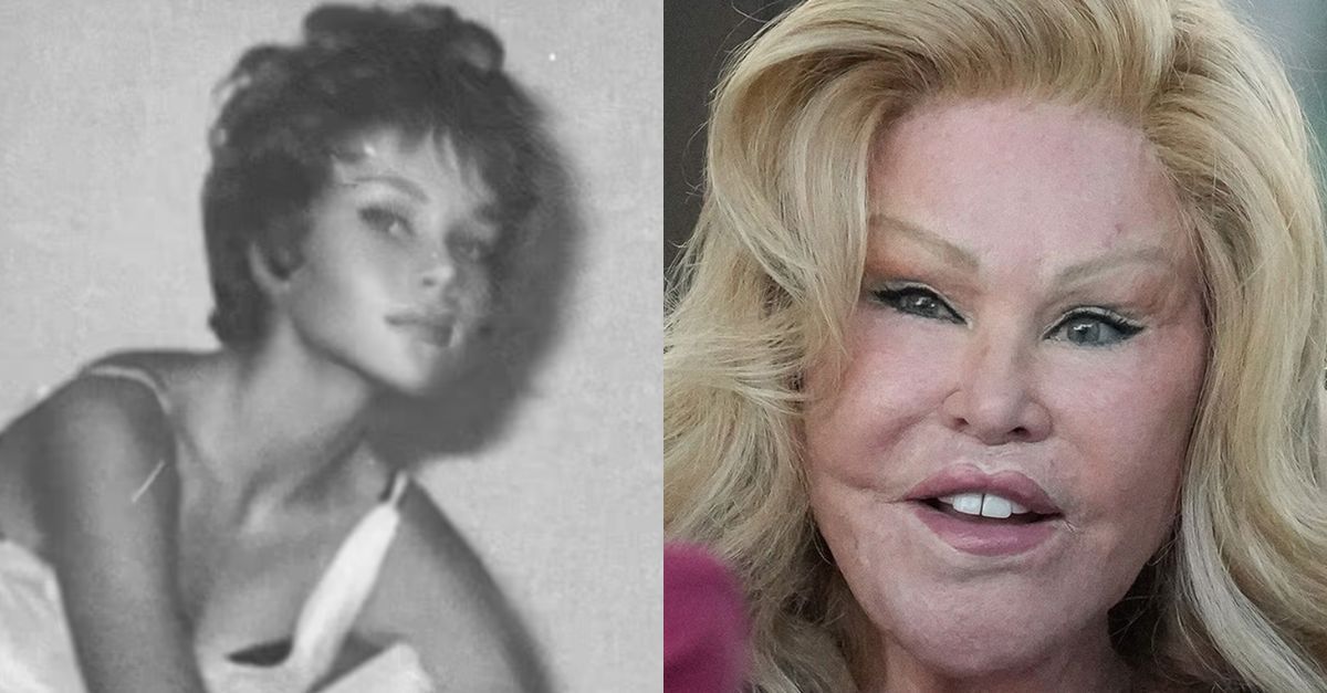 Jocelyn Wildenstein Insists Shes Never Had Cosmetic Surgery