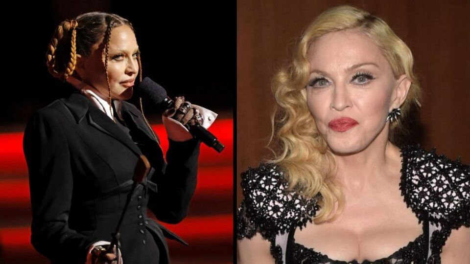 Madonna Reveals ‘New Face’ After Swelling Goes Down