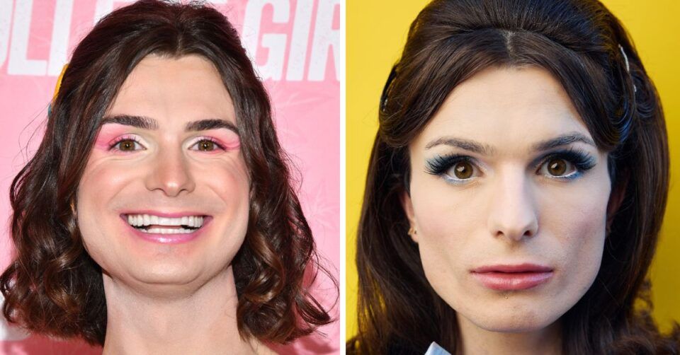 Dylan Mulvaney Reveals Results Of Facial Feminization Surgery